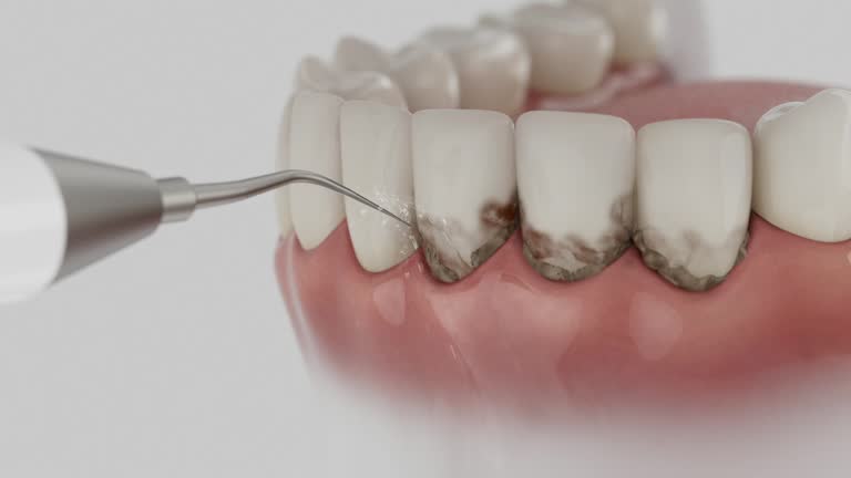 Reliable Dental contractor in Kettering, OH by Dentist Open Now